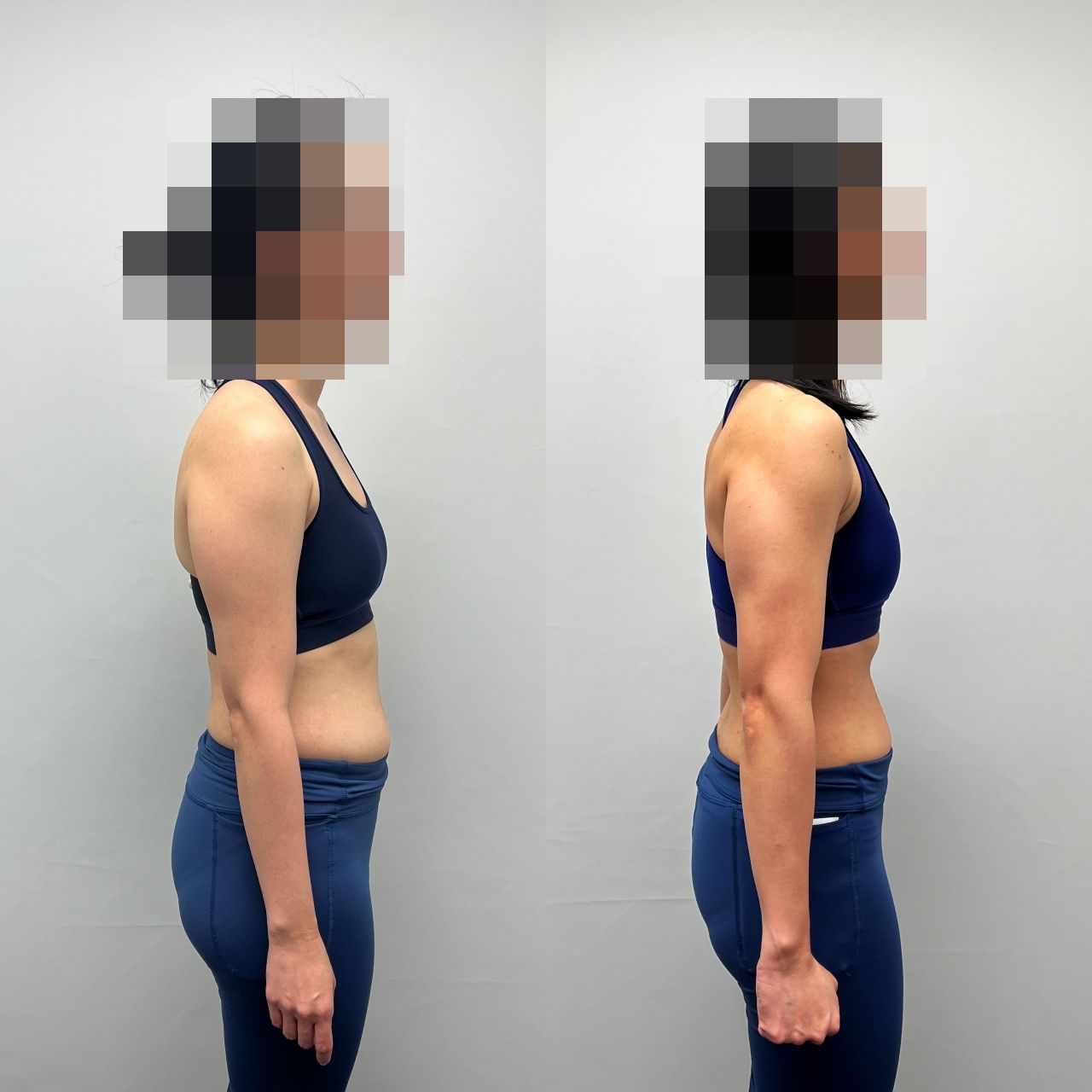 Cheryl C's transformation 3